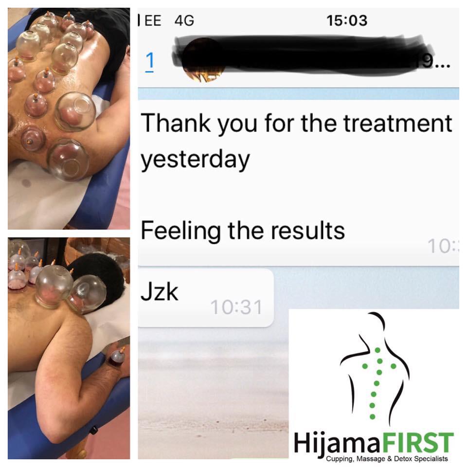 HijamaFirst Reviews
